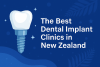 The Best Dental Implant Clinics in New Zealand bikrisohoj